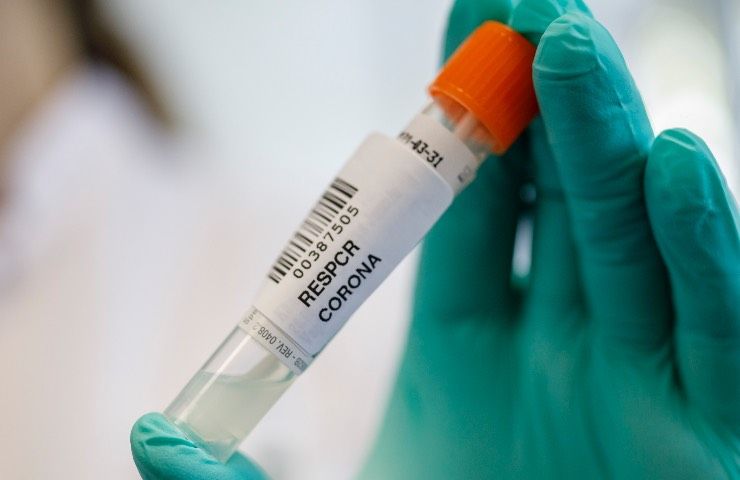 bollettino 25 maggio epidemia oggi