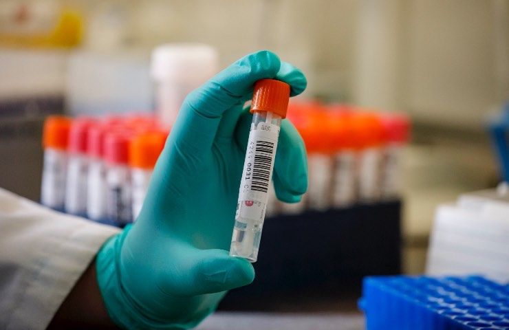 bollettino 5 giugno epidemia oggi