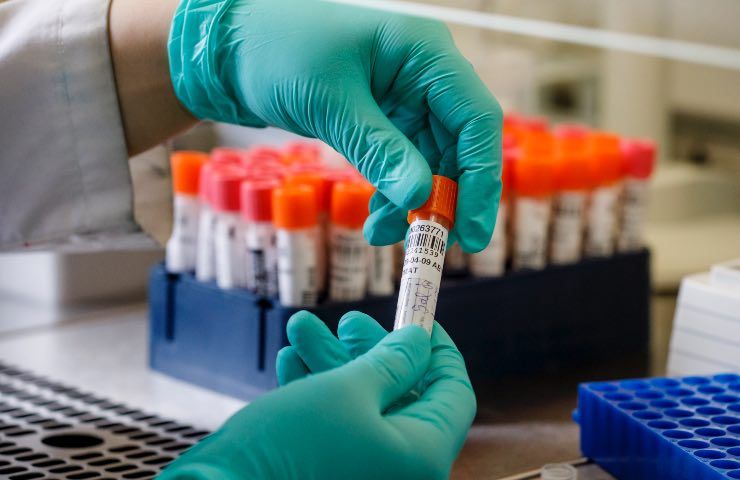 bollettino 31 maggio epidemia oggi