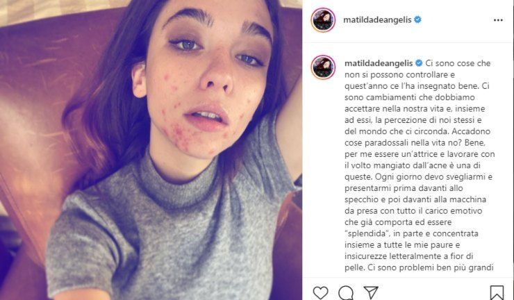 matilda de angelis disturbo