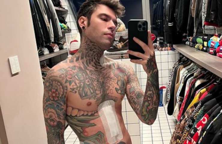 Fedez con la ferita