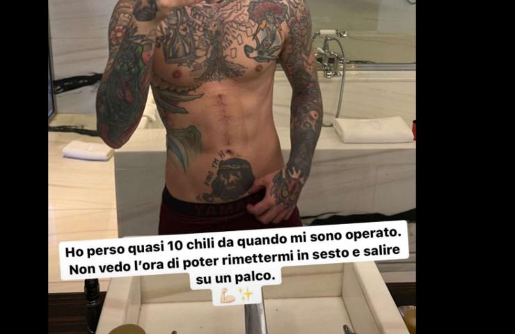 Fedez, il calo